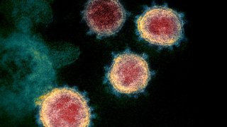 Colorized scanning electron micrograph of SARS-CoV-2, the novel coronavirus that causes COVID-19