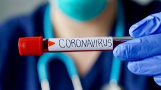 Prueba de coronavirus