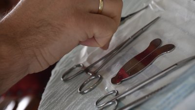 Circuncisión en niños: ¿Práctica preventiva o vulneración de derechos?