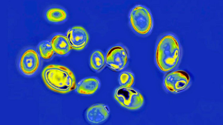 candida auris under microscope