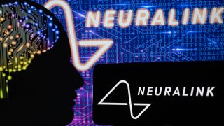 Neuralink