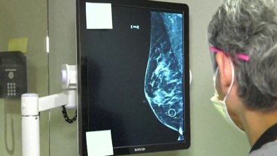 Recomiendan a mujeres realizarse mamografías a partir de los 40 años