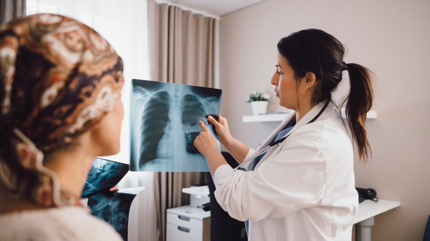 Mujer hispana experta dando consejos a un paciente con cáncer mientras examina una radiografía en la consulta del médico - foto de archivo.